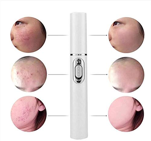 Spider Vein Eraser - Pluma Poderosa Para Eliminar Venas Contra Las Várices