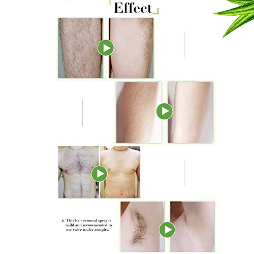 Spray de depilación de 30 ml, Spray para quitar el cabello de 8 minutos, removedor de vello corporal natural sin dolor, inhibir suavemente el crecimiento del vello del brazo, piernas, axilas, axilas