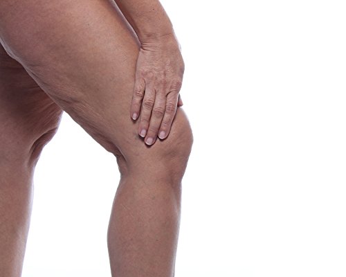 SwissMedicus - Bálsamo para caballos con cáñamo cálido, ideal para deportistas, receta tradicional suiza, extractos naturales de plantas, uso diario, pomada para caballos, 500 ml