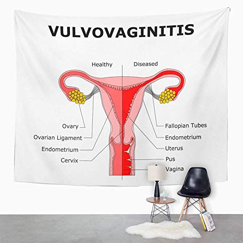 Tapices decorativos Tapestry Wall Hanging Anatomy Vulvovaginitis Color Antique Black Body Bulb Cervix Clitoris Cutaway 60" x 80" Home Decor Art Tapestries for Bedroom Living Room Dorm Apartment