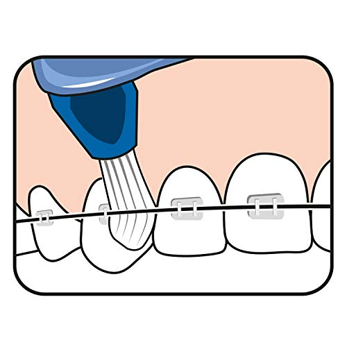 TePe Interspace - Cepillo de dientes manual en ángulo/Cepillo para brackets/Limpieza interdental / 4 cabezales de repuesto/textura mediana/color azul