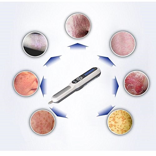 Terapia de luz UVB de mano – Fototerapia de uso doméstico para tratamiento de trastornos de la piel con gafas, aprobado por la FDA