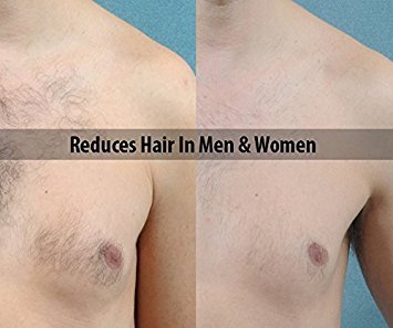 Tweepi Crecimiento De Pelo Inhibidor Serum aceite- Permanente Cuerpo Y Cara pelo retiro- Moderno Día Anti Huevo aceite- Parabeno libre- HECHO EN RU 50 G