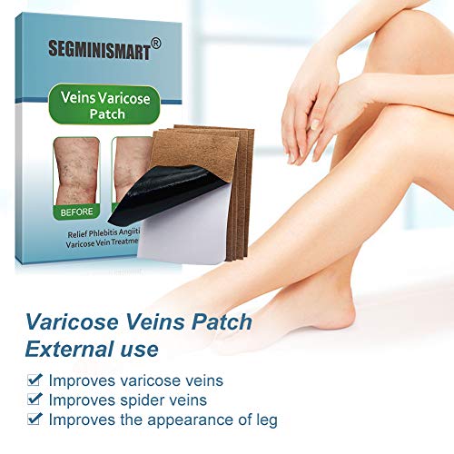 Venas Varicosas,Varicose Vein Treatment,Alivio rápido de Varices,Mejora la circulación sanguínea en las piernas,alivio de flebitis, angiitis, inflamación de vasos sanguíneos