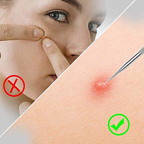VIMILOLO Extractor de Puntos Negros Kit,Herramientas para eliminar puntos negros de Acné para Quita Espinillas Granos Comedones Blackhead removal,Acero inoxidable 6 piezas