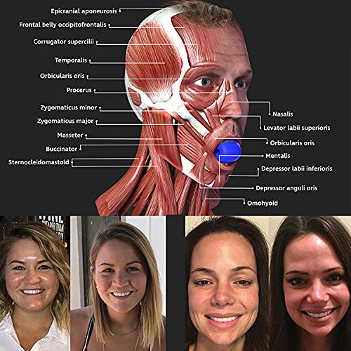 Whiteswan Jaw Trainer, Jawline Trainer, Pino de entrenamiento de tamaño jawzrsize, dispositivo para fortalecer y tonificar la mandíbula y el cuello, define su línea de mandíbula (1 pieza/negro)