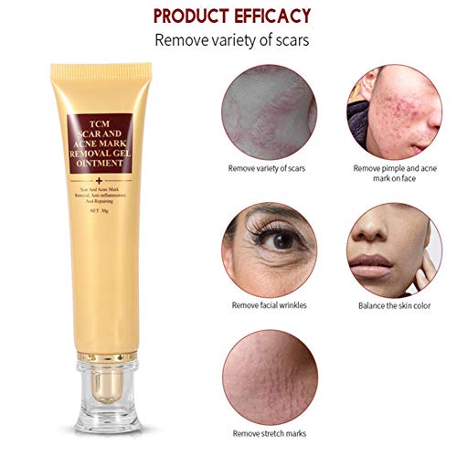 Wiivilik Crema de Cuidado de la Piel Facial 30g Avanzada de la Cicatriz del acné Marcos eliminación de geles de Cuerpo Ungüento acné Post-Parto Cicatriz eliminación Piel