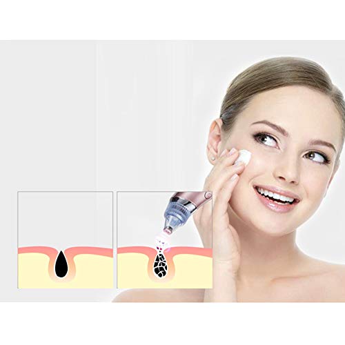 WRJ Limpiadores De Poro Eléctricas Portátiles, Vacío De La Espinilla Piel USB Recargable Poros Limpiador con Cabezales De Aspiración Reemplazables 4,Blanco