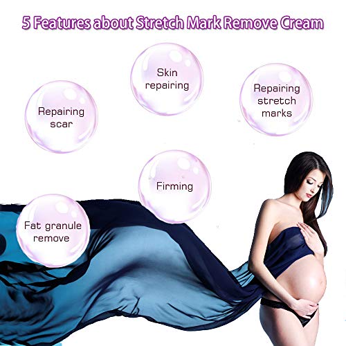 Xnuoyo Crema Antiestrias Embarazo, Crema para Estrías, Eliminar Cicatrices del Embarazo, Stretch Marks Cream, Loción corporal, Crema Corporal Anti Estrías, Reparadora y cicatrizante estrías, 50ml