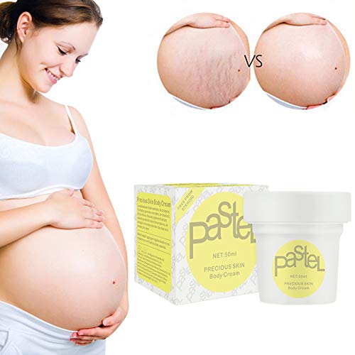 Xnuoyo Crema Antiestrias Embarazo, Crema para Estrías, Eliminar Cicatrices del Embarazo, Stretch Marks Cream, Loción corporal, Crema Corporal Anti Estrías, Reparadora y cicatrizante estrías, 50ml