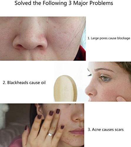 XYQ Recargable cepillo de limpieza facial, exfoliante de silicona removedor de la espinilla limpieza del poro eléctrico Limpiador Facial Brush- Inicio SPA Massager de la cara Adecuado for todo tipo de