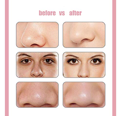 YDYG Remover La Espinilla Hidratación USB Recargable Poro Vacío Y Arandela Aspiradora Inalámbrica Agua Reponer El Agua Ciclismo Comedone Extractor De Humedad De La Piel Replenish