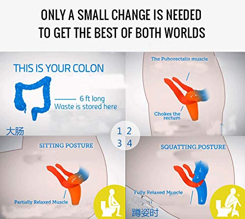 YSYW Original Taburete para Inodoro contra Hemorroides, Estreñimiento, Colon Irritable, Flatulencias, Distensión Abdominal/para Limpieza Intestinal, WC - Retrete - Hemorroides Home,Green