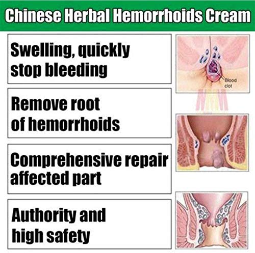 YUYIHAN Crema de hemorroides a Base de Hierbas Chinas Síntesis de Plantas Naturales de montaña Profunda Alivia la picazón Ardor y molestias (1PCS)
