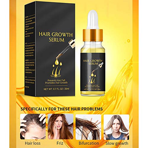 YYDS 1/2/5 Pcs Hair Growth Serum,Anti Hair Loss Serum with Ginger,Scalp Tonic for Hair Growth,for All Types of Skin and Hair,20ML (2PCS)