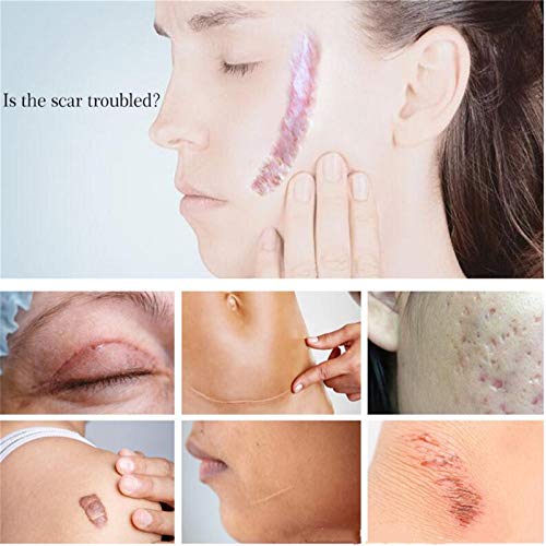 ZGBQ Crema removedora de Marcas de Estiramiento de Cicatrices de acné Crema Facial reparadora Cuidado de la Piel Aclarar, Crema reparadora de Cicatrices de Lavanda (1 Pieza)