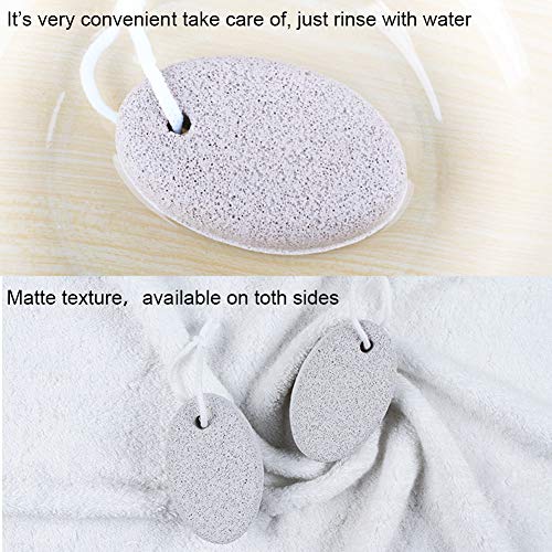 Zhongtou 2 piezas de piedra pómez de lava natural piedra removedora de callos blanca para pies duros/manos/piel/exfoliación corporal removedor de piel muerta para hombres/mujeres