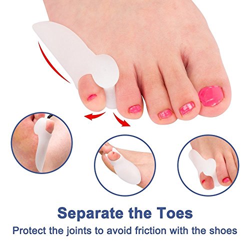2 Pares Juanete Protector Gel Cojín Pad Alivio del Dolor Hallux Valgus Toe separador de silicona, Enderezador para pequeño dedo del pie, corrector de juanetes