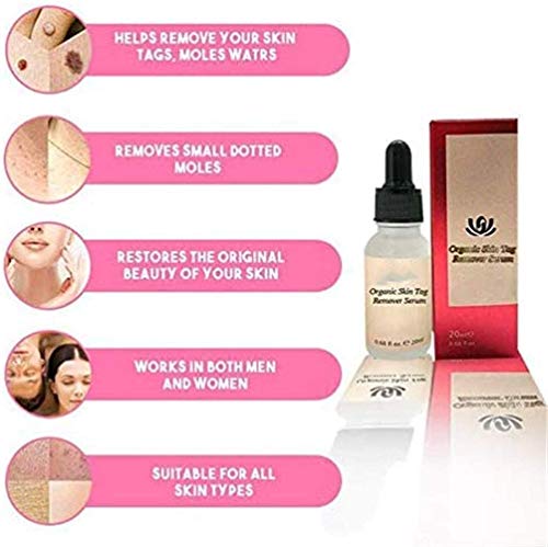 2 Pcs Solución de eliminación de etiquetas de lunares y piel Piel de lunares indoloras Eliminación de manchas oscuras Etiqueta de verrugas faciales Crema de eliminación de pecas Yeso de aceite 20 ml