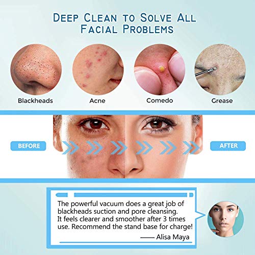4-IN-1 Limpiador de Poros, Facial Electrico Removedor de Espinillas y Extractor Punto Negros, Quitar Puntos Negros 4 succión con USB Carga Portátil Eliminador de Espinillas y Acné