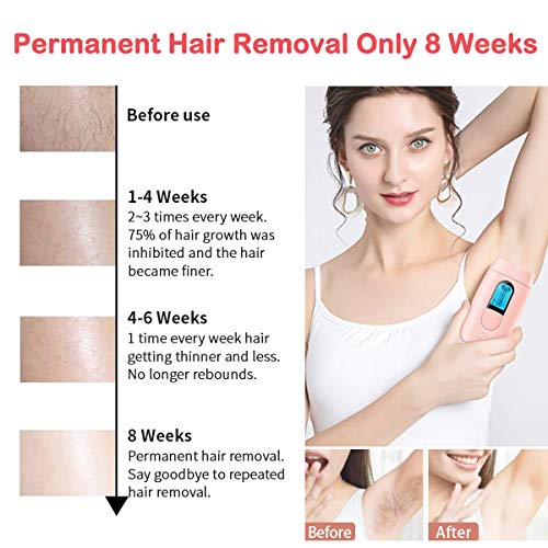 ACTION IPL Depiladora de Luz Pulsada para Mujer, 990,000 Flashes Maquina Depilacion Laser Permanente del Vello Visible en Casa para Facial, Axilas, Espalda, Piernas y Zona Bikini, Rosa