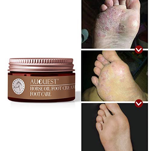 AJUMKER Aceite de caballo Crema para pies Cuidado de los pies Crema Hidratante Comezón de ampollas Reparación Anti-agrietamiento Suavizante antifúngico Peeling Cuidado de los pies