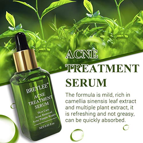 ARTIFUN Acné Tratamiento Anti Acne Serum, Eliminar Espinillas, Puntos Negros y Granos, Anti Imperfecciones Tratamiento contra el acne
