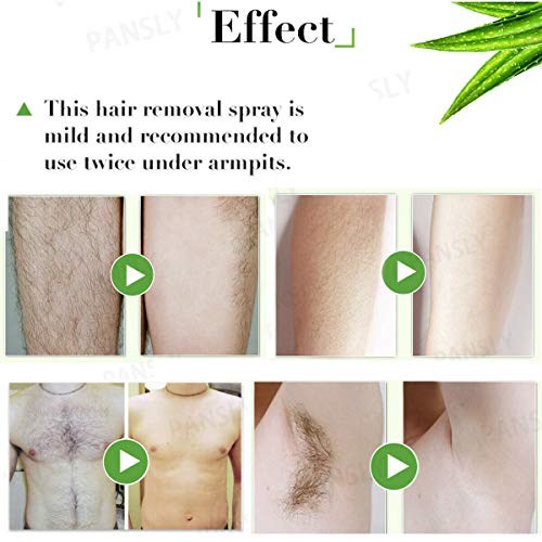 Bareit Spray depilatorio, Hair Removal Spray semipermanente natural, Spray inhibidor del crecimiento del cabello Stop, Limpiador sin dolor Eliminador de corporal Pierna Axila Manos Facial (A+B)