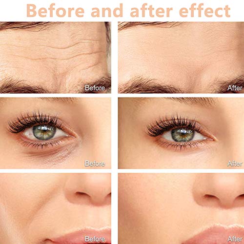 BESTZY Beauty Bar 24k Golden Beauty Bar Pulse Facial Massager, 24k Masajeador Facial Rodillo Facial Antiarrugas en Forma de T para Piel Apretada, Estiramiento Facial, Antiarrugas