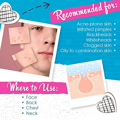 Bye Bye Blemish for Acne Drying Lotion - Results Overnight