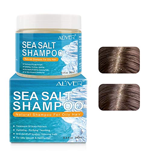 Champú para la psoriasis, champú anticaspa, champú para el tratamiento del cabello con sal marina, champú para el tratamiento del cuero cabelludo con picazón para la psoriasis del cuero cabelludo