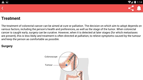 Colon Cancer