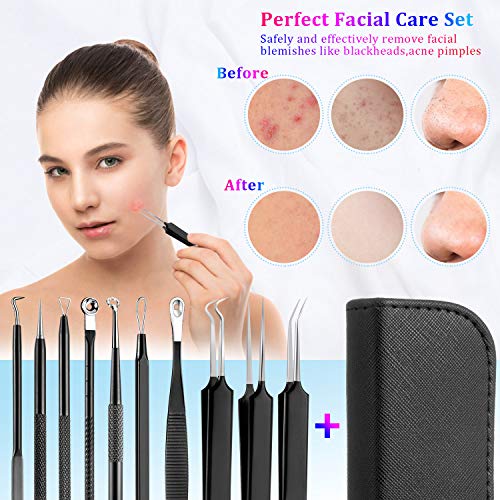 Comius Sharp 10 Piezas Kit de Eliminación de Puntos Negros, Kit Removedor de Espinillas de Acero Inoxidable Profesional con Funda de Cuero, para Eliminar Puntos Blancos (Negro)