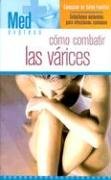 COMO COMBATIR LAS VARICES (Med Express)