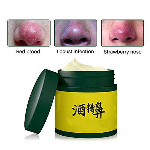 Crema nasal de rosácea para la reparación de la nariz Ungüento Rosácea Ácaros de la nariz roja Anti Acné Estudios Eliminador de espinillas