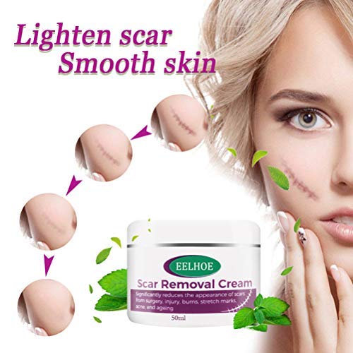 Crema para cicatrices, gel para eliminar marcas de estiramiento, crema para eliminar cicatrices para eliminar cicatrices antiguas y nuevas para el tratamiento de cicatrices en hombres y mujeres