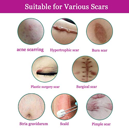 Crema para cicatrices, gel para eliminar marcas de estiramiento, crema para eliminar cicatrices para eliminar cicatrices antiguas y nuevas para el tratamiento de cicatrices en hombres y mujeres