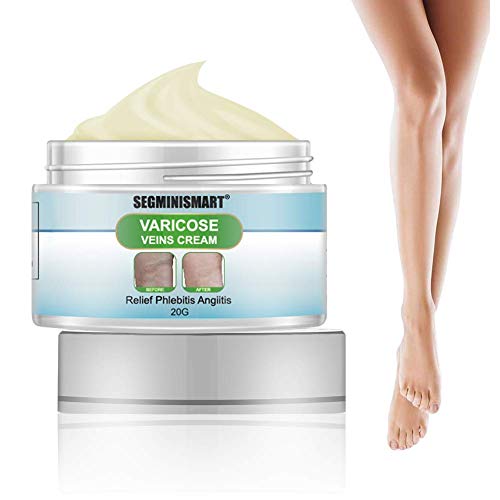 Crema para venas varicosas,Alivio de crema para venas varicosas,Crema de Venas Varicosas Crema Calmante para Piernas,Tratamiento de Venas de Araña para Piernas