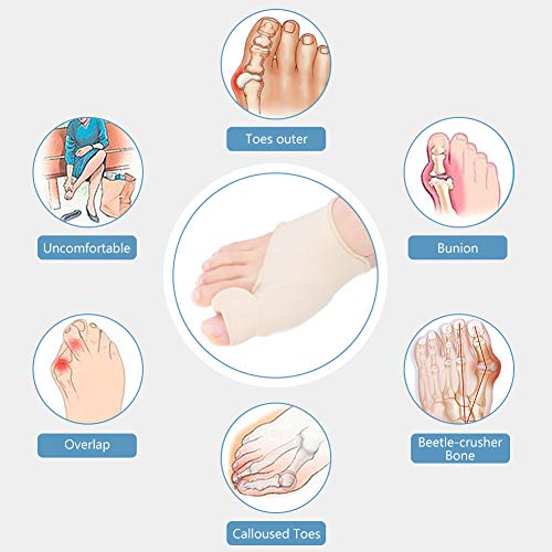 DOACT Corrector de Juanetes, Hallux Valgus de Corrector, Con Almohadilla de Gel de Silicona, para Tratar El Dolor Hallux Valgus Incluye Noche Tratamiento y Dia Asistencia (L)