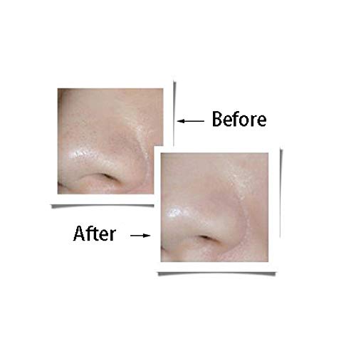 Drametree Acero inoxidable Acné Aguja Acné Acné Exprimidor Aguja Ir Negro Pin Herramientas de cuidado de belleza Cejas y nariz Conjunto de cabello Herramienta de eliminación ideal hecha de acero quirú