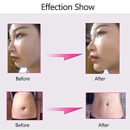 DXMBHL Hialurónico Inyección Bolígrafo Equipo Jeringuilla Nebulizador Sin Aguja Inyección para Salones de Belleza caseros Eliminación de Arrugas Reposición Hidratante,A