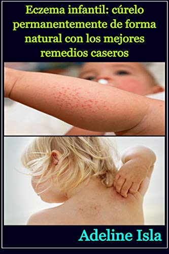 Eczema infantil: cúrelo permanentemente de forma natural con los mejores remedios caseros