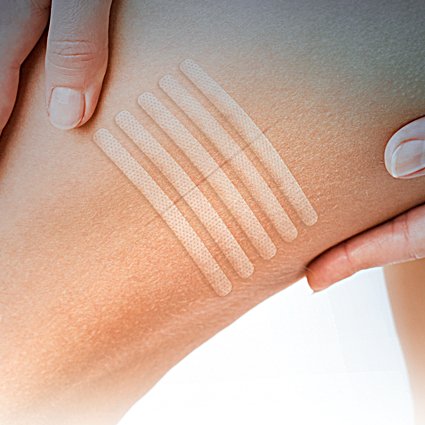 Eurosuture (mm 3 x mm 75) Tiras Estériles Para Sutura Cutánea, Adhesivo Hipoalergénico, Efecto Descolorado para un Mejor Resultado Cosmético. Fabricado en Italia, 10 Unidades