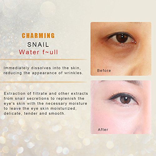 Eye Cream, 100% Natural Secretos Mucus Extract Eye Serum Elimina los Círculos Oscuros y las Bolsas para Debajo y Alrededor de los Ojos
