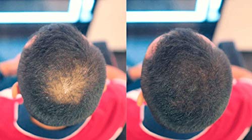 Fibras Capilares, con Queratina Natural, Probado por Dermatólogos, Para diferentes Tonos de pelo, Construcción de Cabello, Fibras Naturales, Alopecia, Calvicie 25gr. (NEGRO)