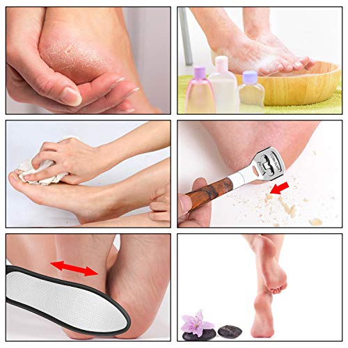 Foot Callus Remover Set, Premium Foot Rasp Best for Smooth Away Hard Callus, Dead Skin and Crack Skin. Profession Foot Files with gift box