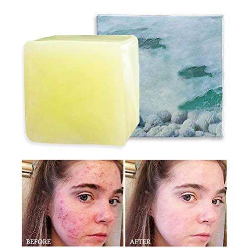 FuYouTa Jabón de sal marina Jabón para el acné, jabón de sal marina, jabón natural hecho a mano, jabón facial, aceites para el control del jabón facial, para el eccema del acné