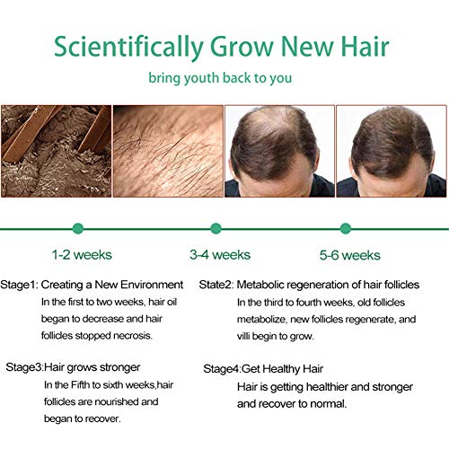 Hair Growth Serum,Hair Growth Essential Oil,Hair Serum,Hair Oil For Hair Growth- Hair Growth & Hair Thickening,Natural Herbal essence Anti Hair Loss Hair Serum