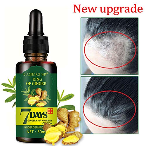 Hair Growth Serum,Hair Growth Essential Oil,Hair Serum,Hair Oil For Hair Growth- Hair Growth & Hair Thickening,Natural Herbal essence Anti Hair Loss Hair Serum