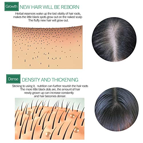 Hair Growth Serum,Hair Growth Essential Oil,Hair Serum,Hair Oil For Hair Growth- Hair Growth & Hair Thickening,Natural Herbal essence Anti Hair Loss Hair Serum